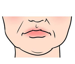 ブルドッグ顔